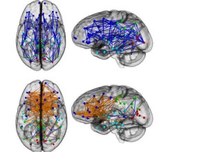 Los cerebros de hombres y mujeres estructuran sus conexiones de manera diferente