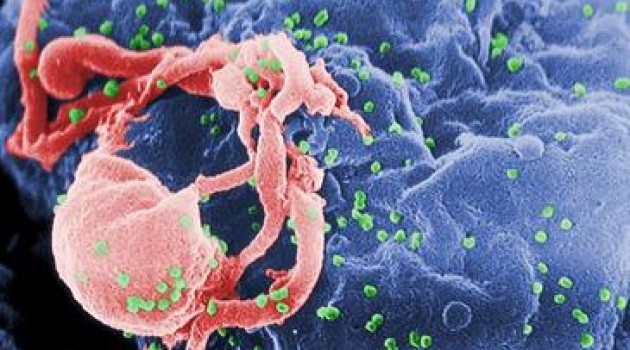 Rastrean por primera vez la batalla entre el VIH y un sistema inmunitario capaz de defenderse