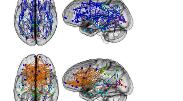 Los cerebros de hombres y mujeres estructuran sus conexiones de manera diferente