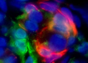 Nueva luz sobre la generación de neuronas a partir de células madre en adultos